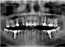 live patient externship implantology Australia
